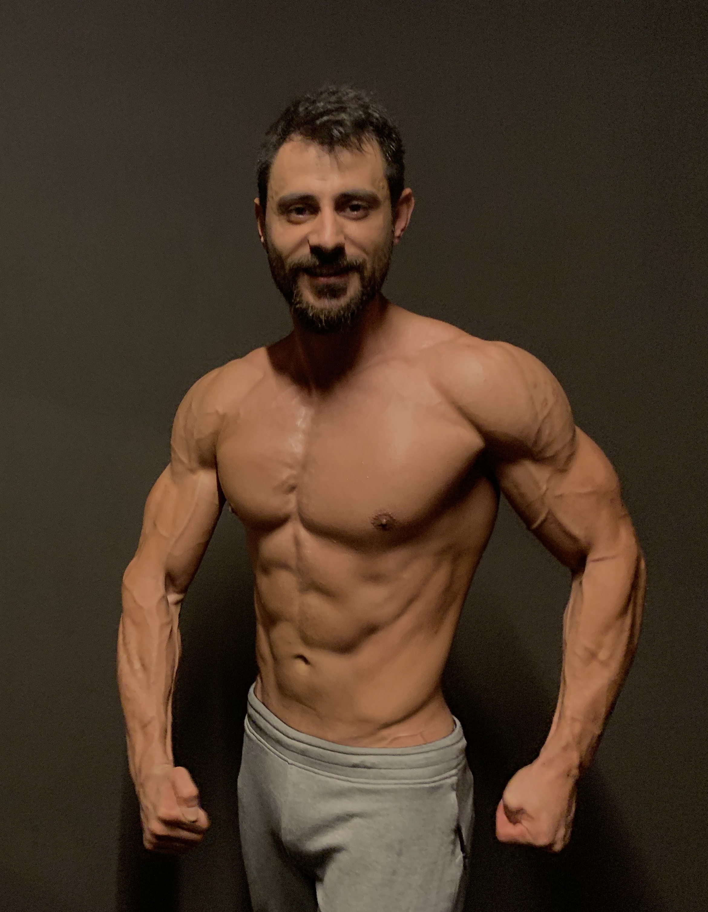 Ahmet Akyıldız